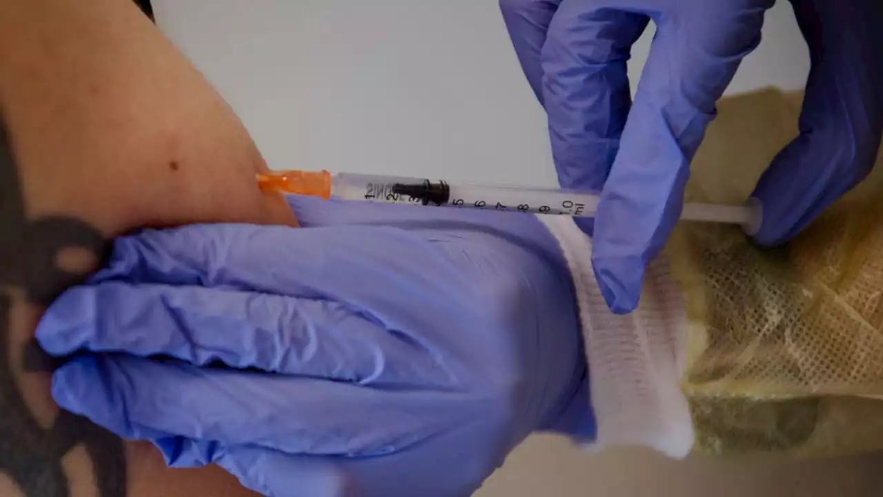 Santa Clara County expands monkeypox vaccine eligibility