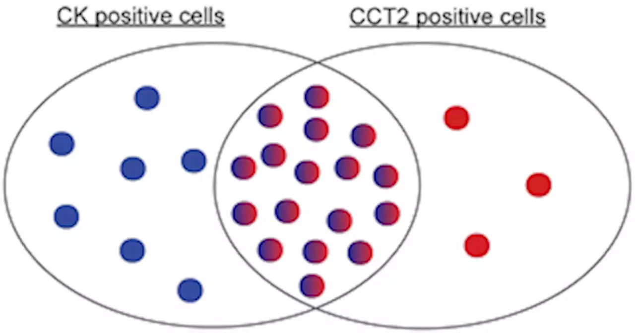 Chaperonin containing TCP1 as a marker for identification of circulating tumor cells in blood