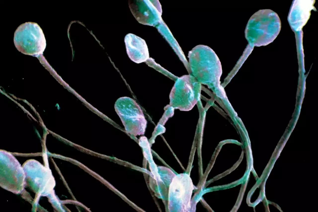 What we know so far about how covid-19 affects sperm