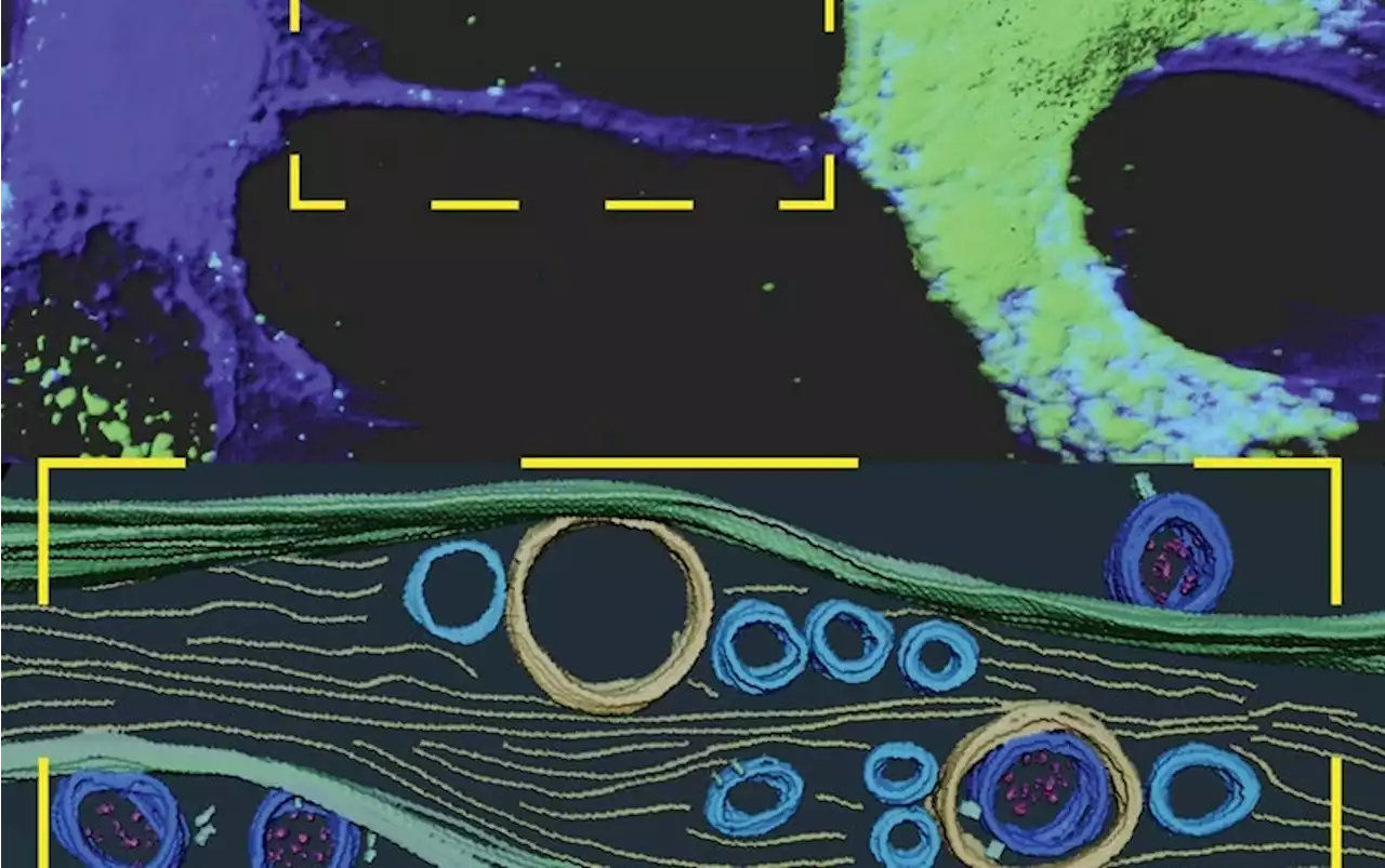 COVID Virus May Tunnel through Nanotubes from Nose to Brain