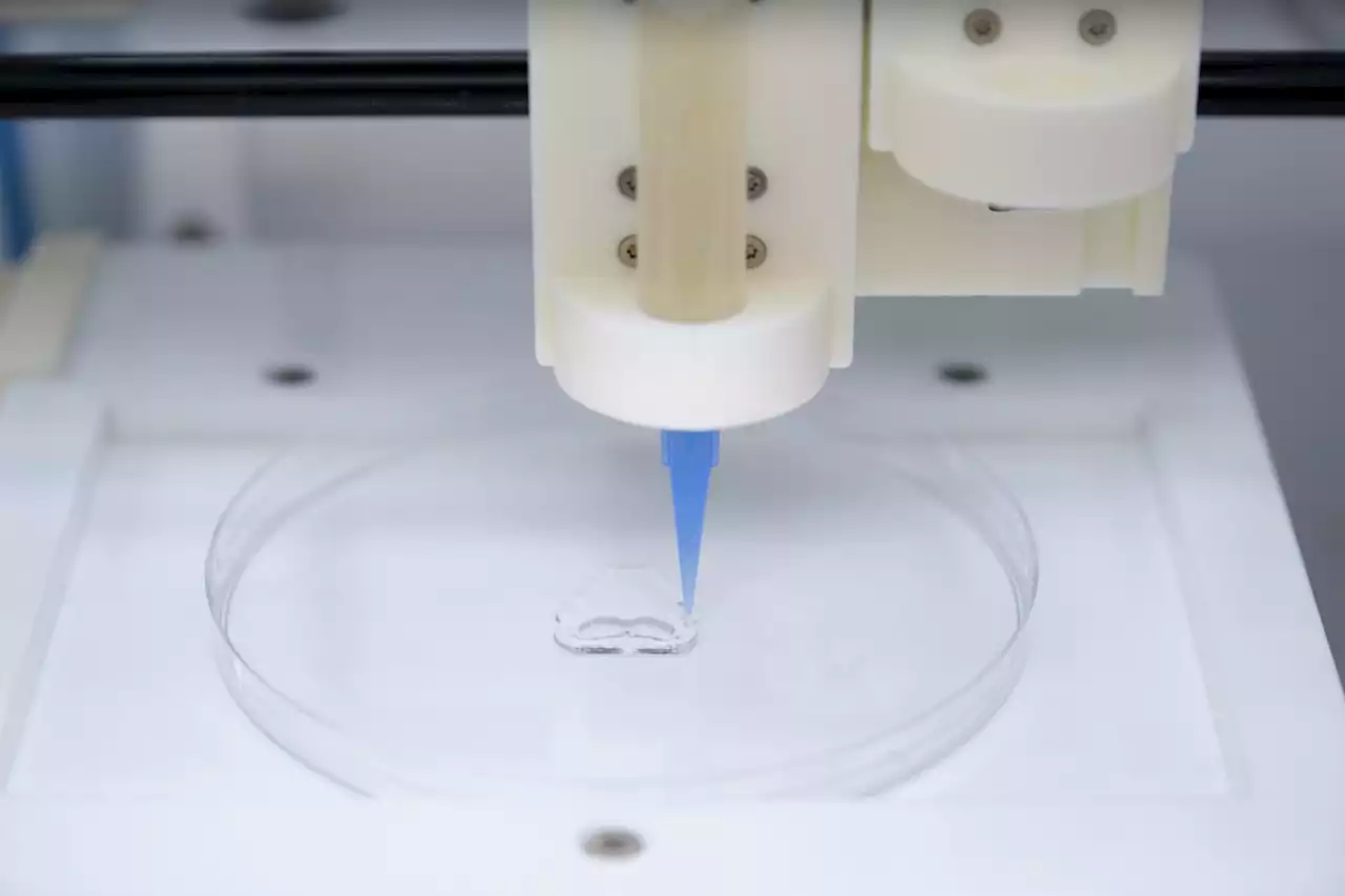 Will 'Bioprinting' Body Parts Lead To Crazy Cosmetic Requests?