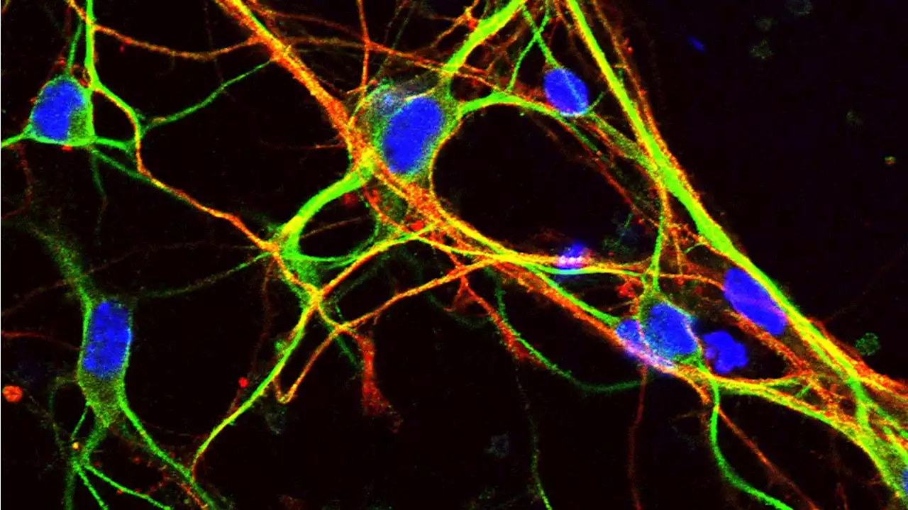 Scientists Unravel the Mystery of “Junk” Genes That Are Key to Brain Development