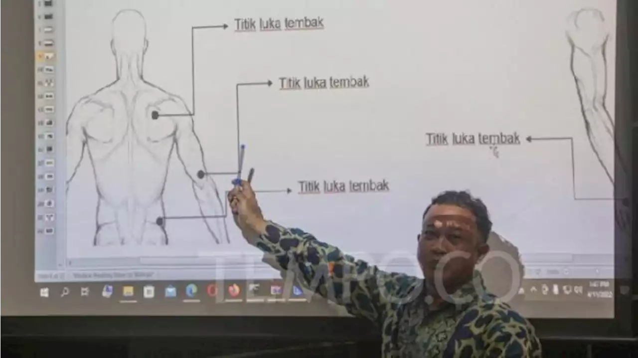 Soal Luka di Tubuh Brigadir J, Komnas HAM Bakal Minta Keterangan Ahli