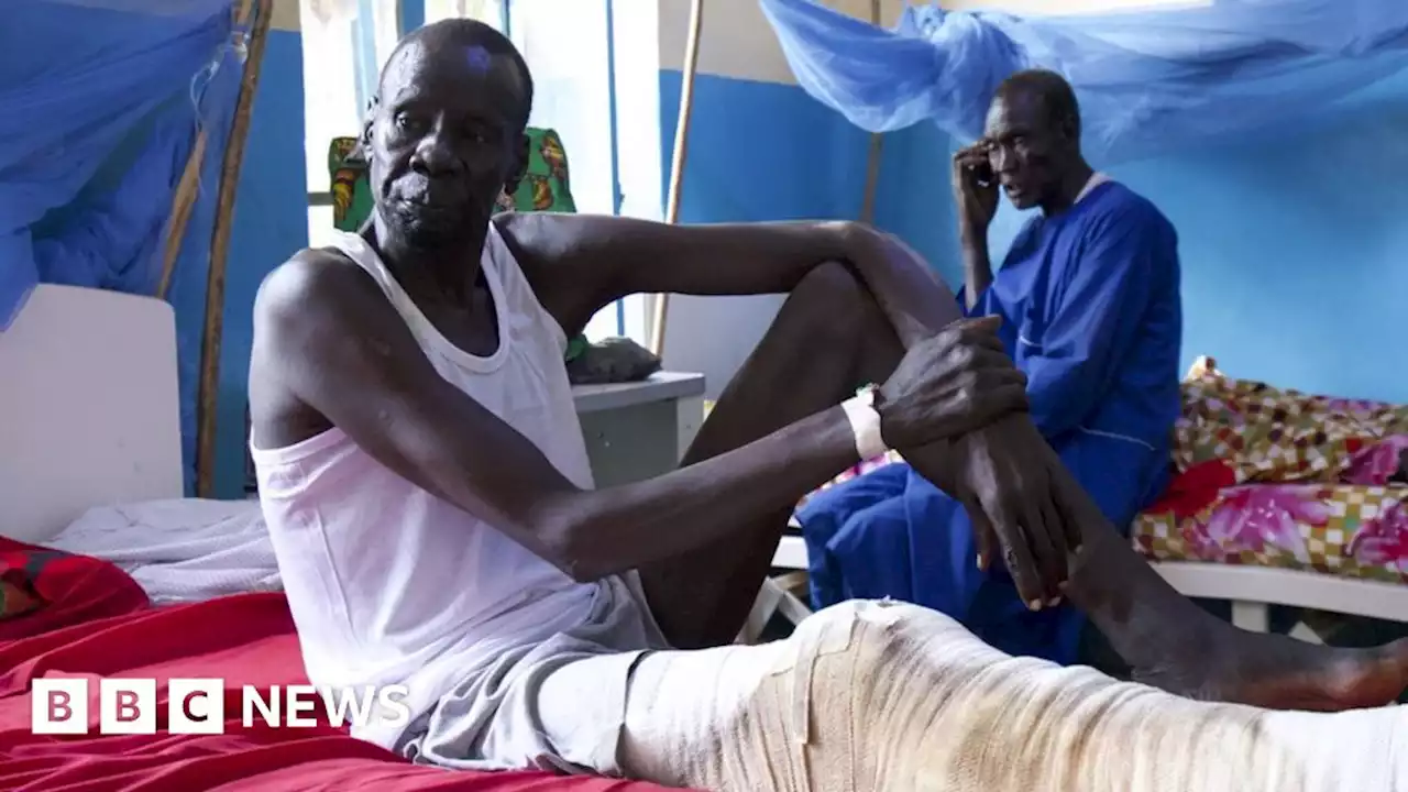 What UK aid cut means for one South Sudan hospital