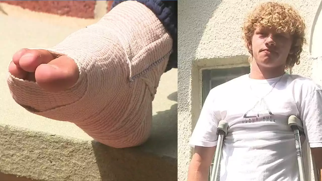 Teen surfer bitten by shark on Long Island speaks out