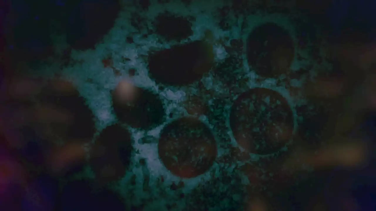 Maine Reports First Case of Monkeypox