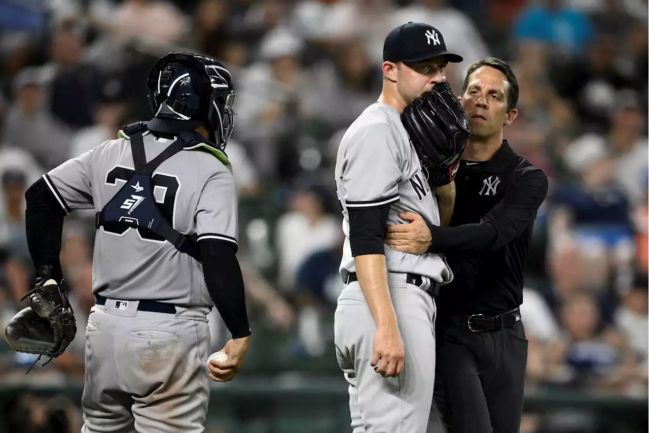 Michael King’s Yankees season over with fractured elbow