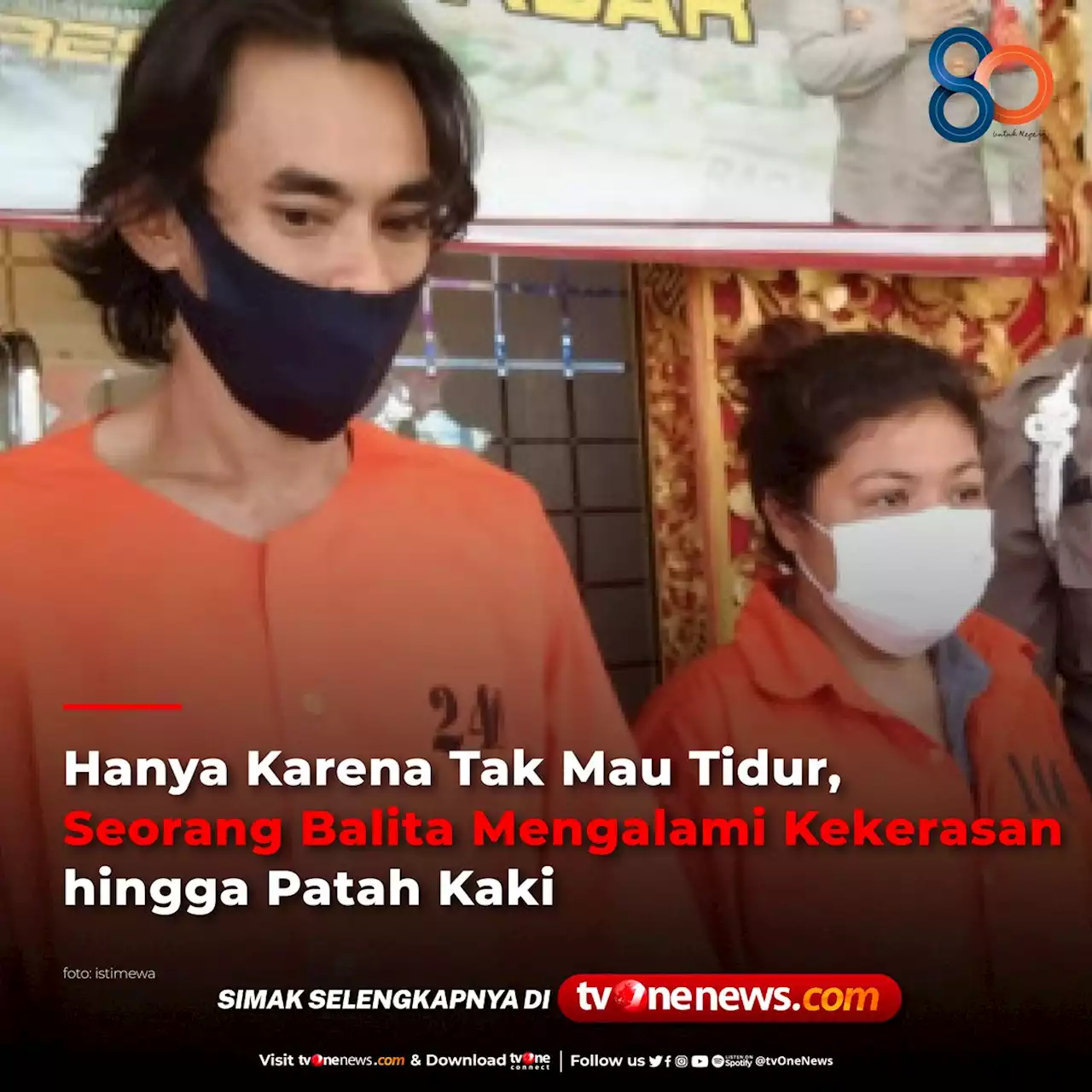 Hanya Karena Tak Mau Tidur, Seorang Balita Mengalami Kekerasan hingga Patah Kaki