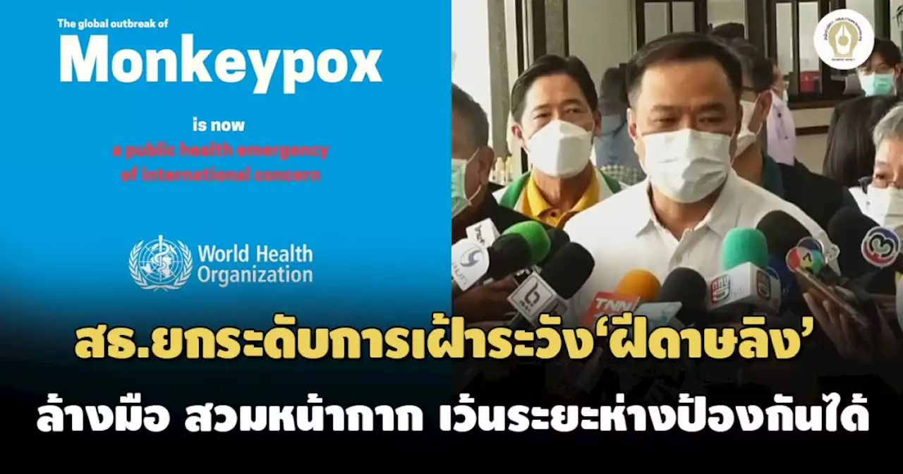 สธ.ยกระดับเฝ้าระวัง'ฝีดาษลิง' 'อนุทิน'แนะสวมหน้ากาก ล้างมือ เว้นระยะห่างรับมือ 2 โรค