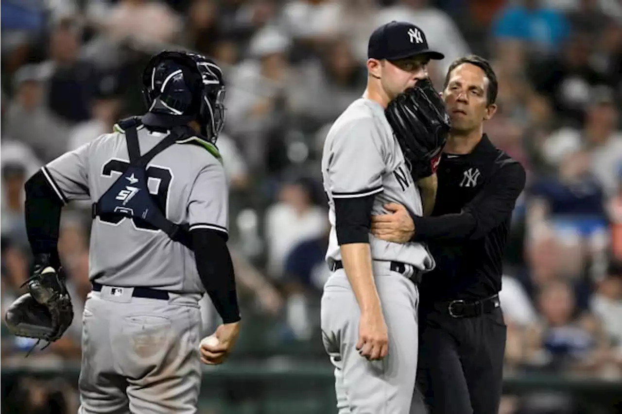 Yankees reliever King out for season with fractured elbow