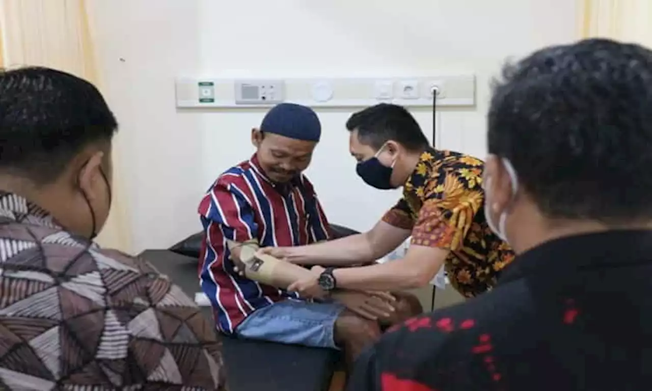 Alhamdulillah, Tim RSUD Soediran Pasang 2 Tangan Palsu Warga Jatipuro