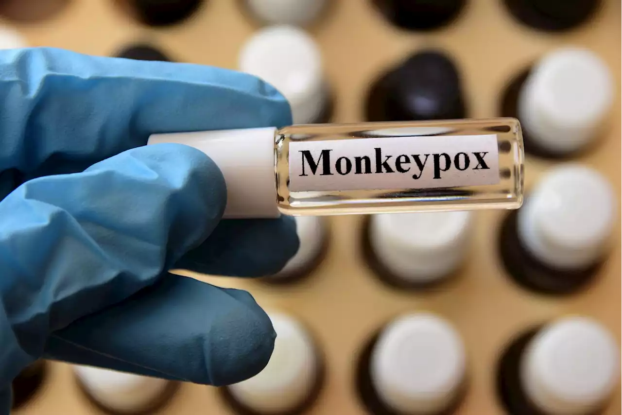 Variole du singe : comment se faire tester ?