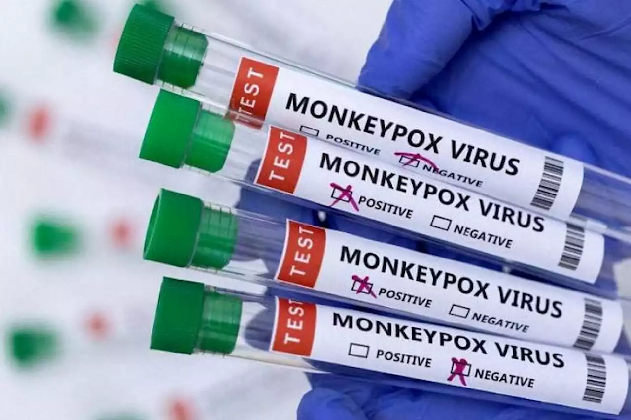 7th and 8th cases of monkeypox confirmed in Singapore
