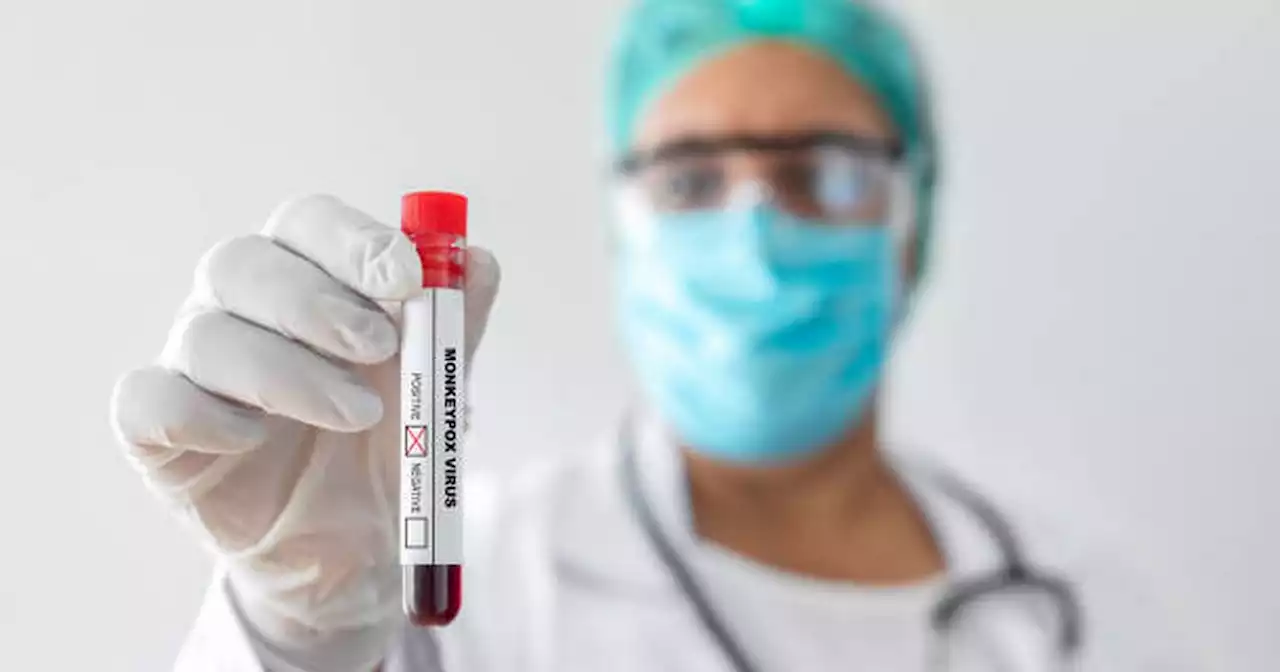 Vaccine to be rolled out for Irish people 'at risk' from monkeypox