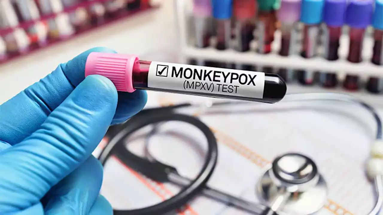 Should Monkeypox Be Considered an STD? Experts Debate