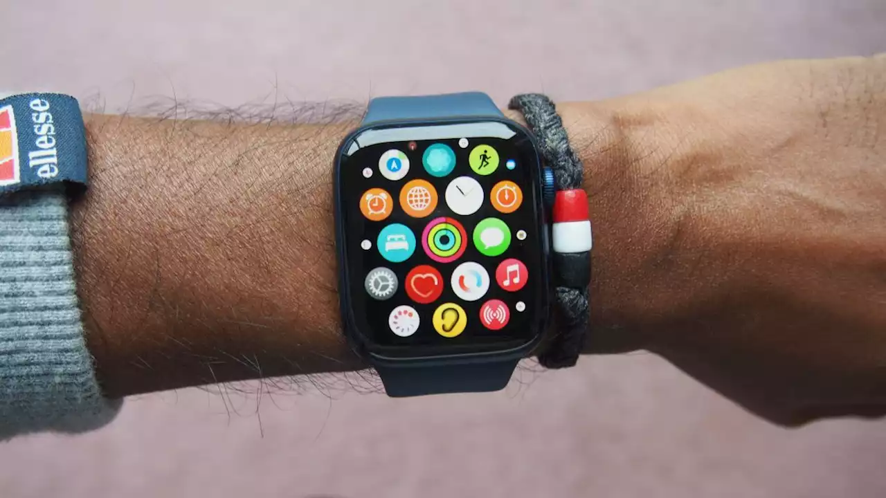 No matter what Apple does, the next Apple Watch won't be perfect