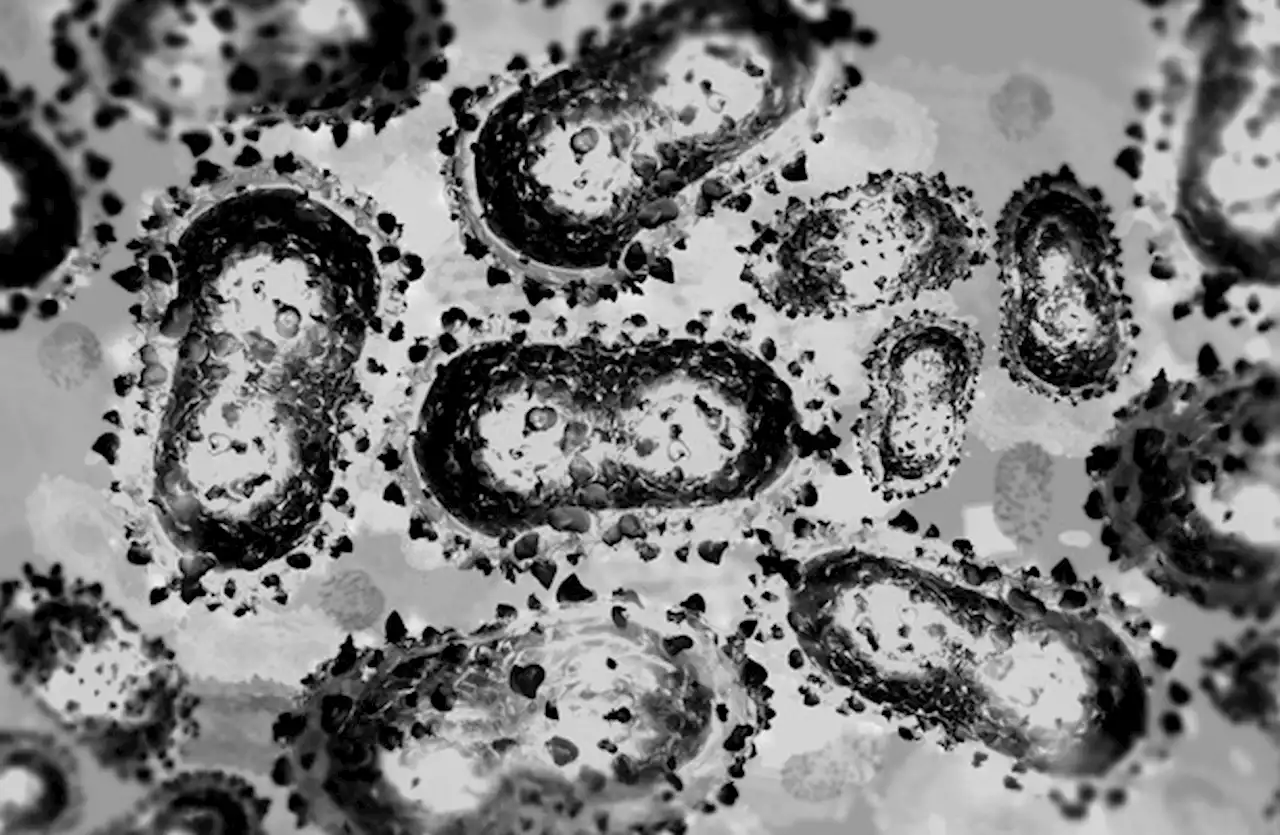 Monkeypox: Use of smallpox vaccine to be extended to groups at high risk of exposure