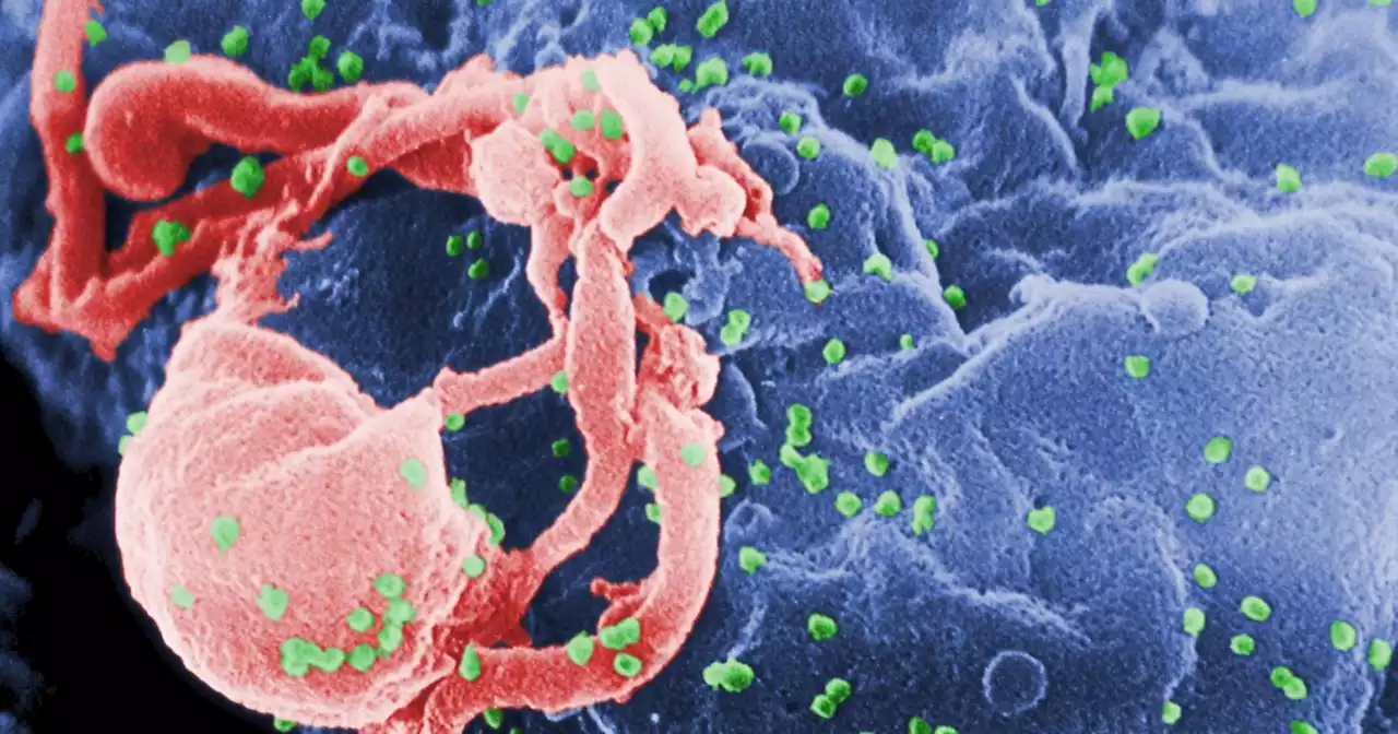 66-year-old believed to be oldest person cured of HIV