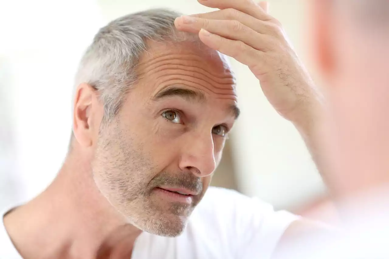 The key to a permanent cure for baldness may have been discovered