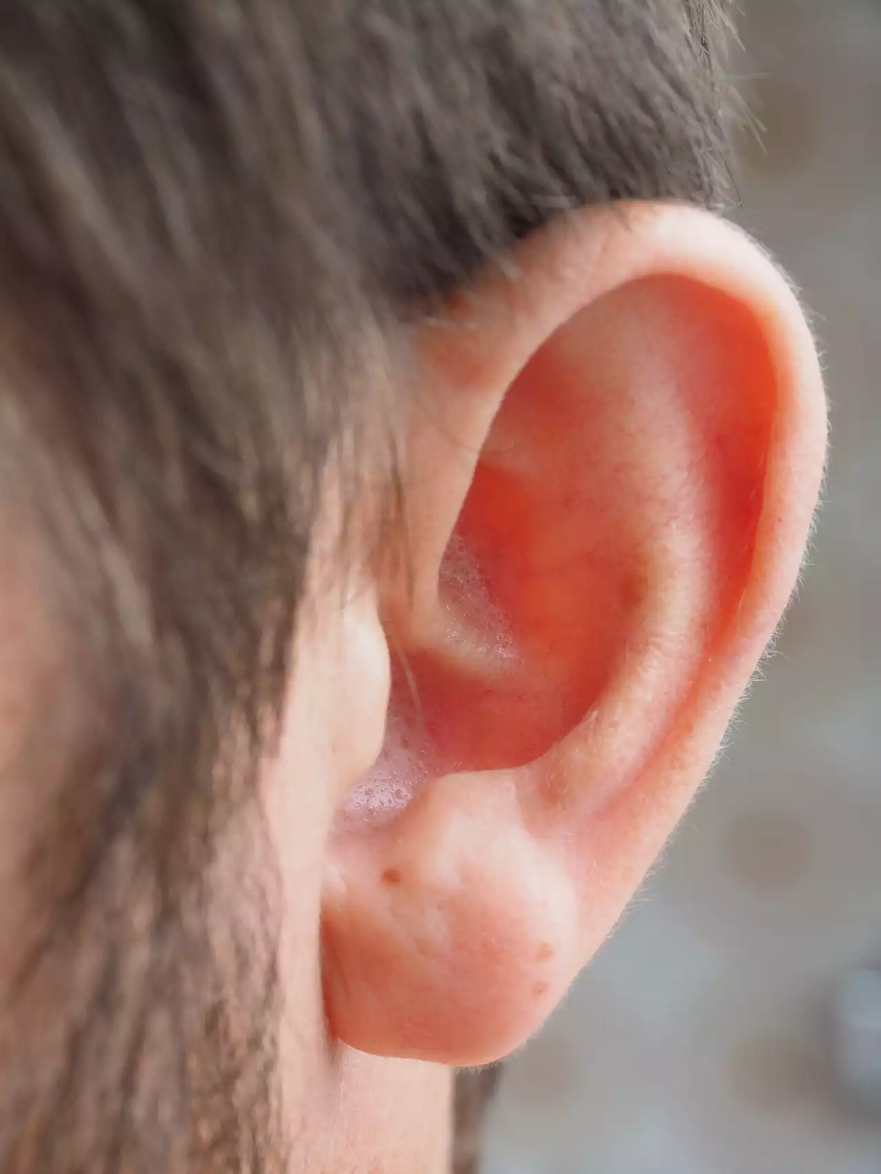 Hearing loss and tinnitus are common in cancer survivors