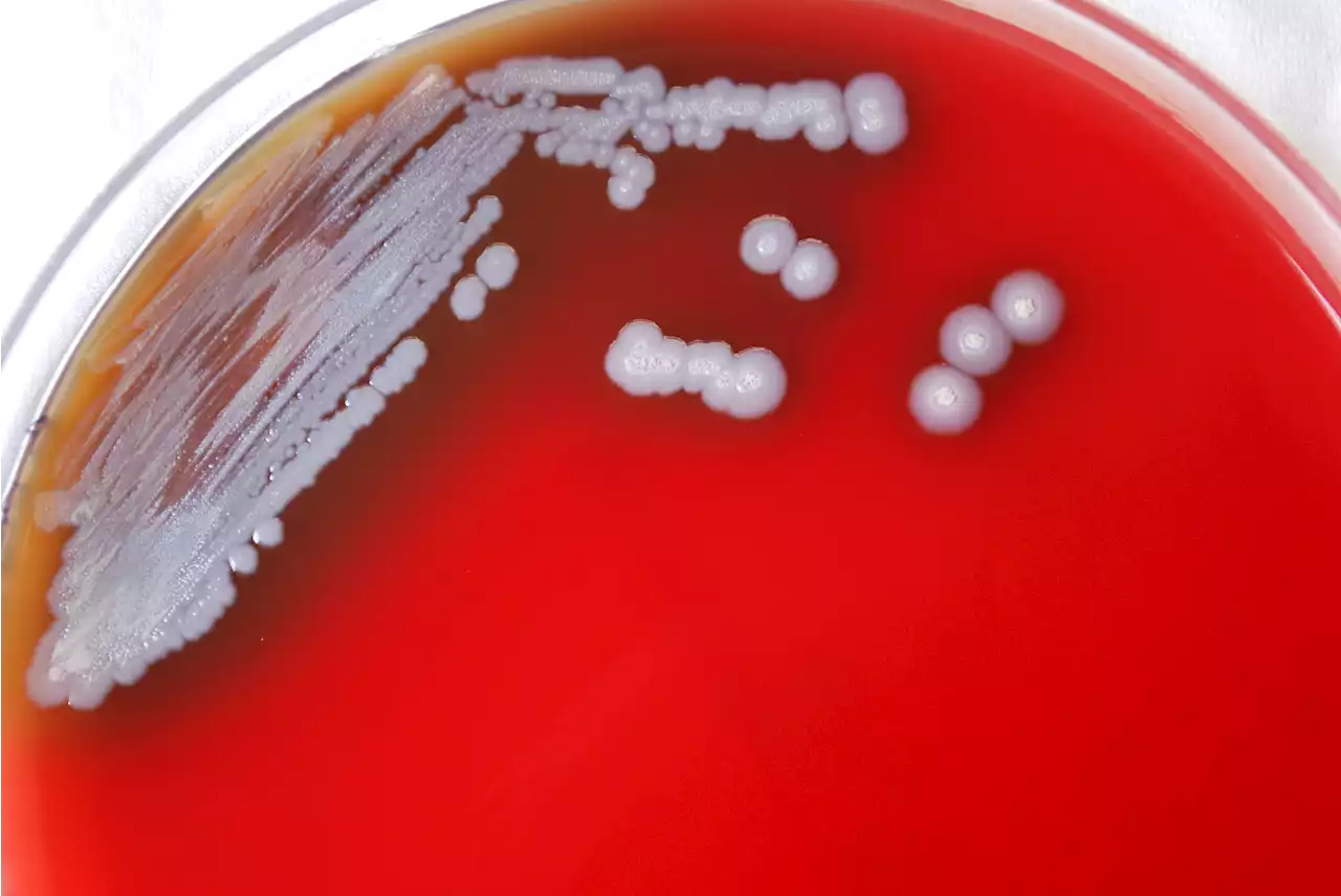 CDC Issues Alert After Bacteria That Causes Deadly Disease Is Detected in US for 1st Time