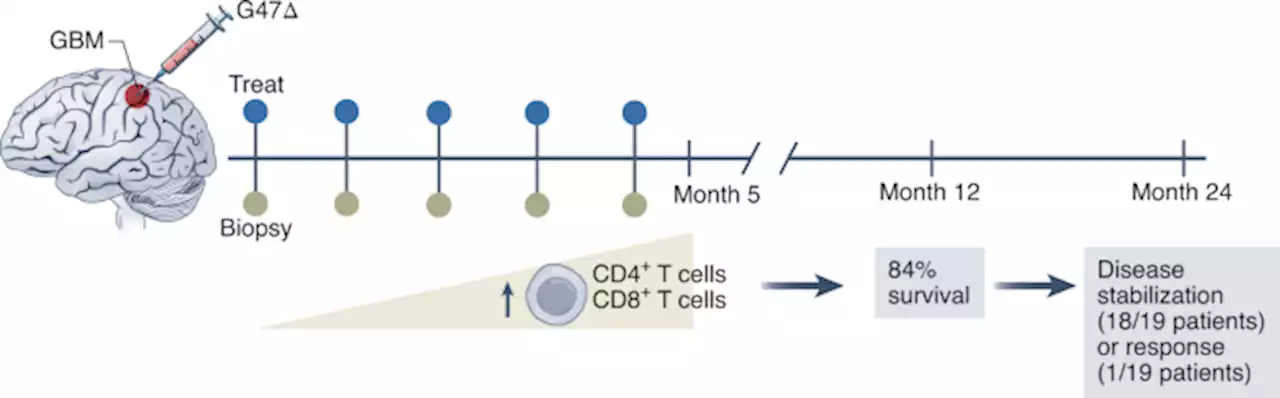 Treat and repeat: oncolytic virus therapy for brain cancer - Nature Medicine