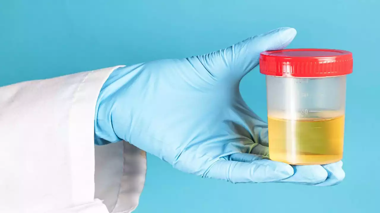 This new AI assesses urine flow as well as physicians