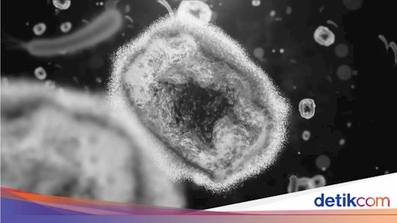 Disorot IDI, Begini Urutan Gejala pada Orang Terjangkit Virus Cacar Monyet