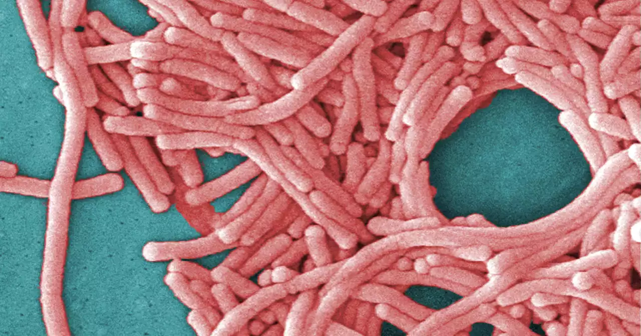 Napa county health officials investigating Legionnaires' disease outbreak