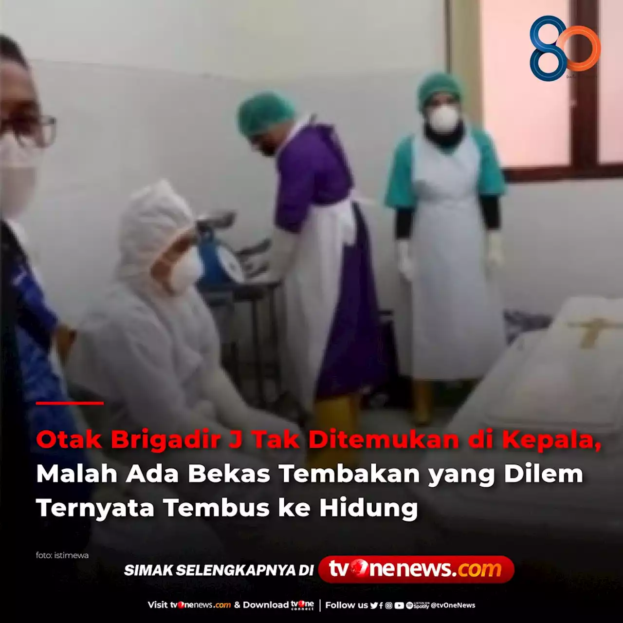 Otak Brigadir J Tak Ditemukan di Kepala, Malah Ada Bekas Tembakan yang Dilem Ternyata Tembus ke Hidung