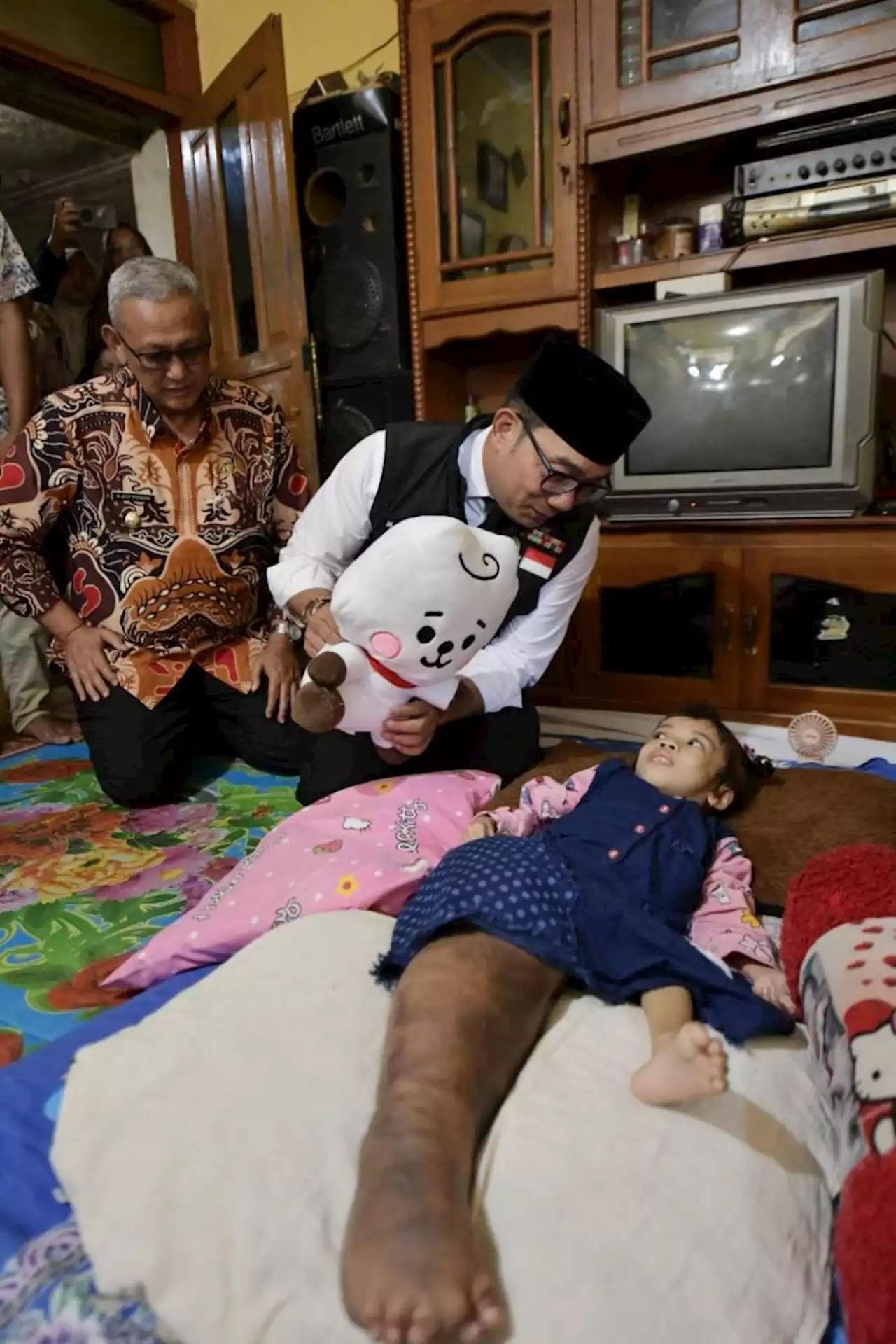 Ridwan Kamil Beri Bantuan ke Anak yang Kakinya Terkena Kanker Ganas |Republika Online