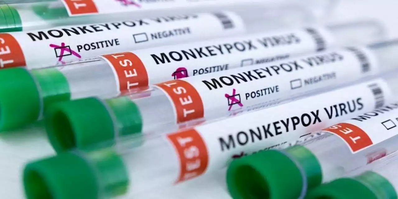 New York City declares monkeypox a public health emergency - SABC News - Breaking news, special reports, world, business, sport coverage of all South African current events. Africa's news leader.