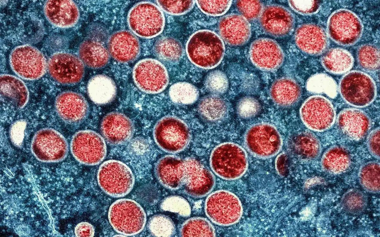 Monkeypox could signal dawn of a new STI in men as ‘uncontrolled’ global spread continues