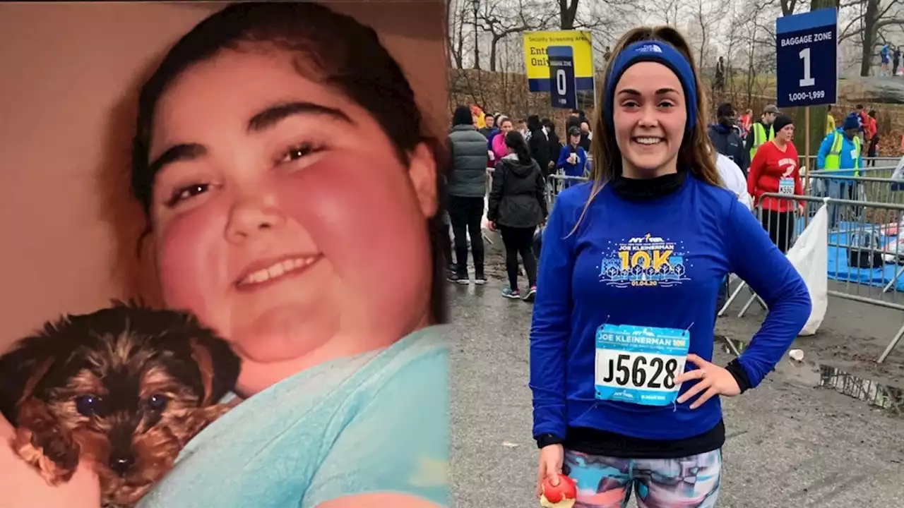 Rare childhood disease survivor becomes marathon runner