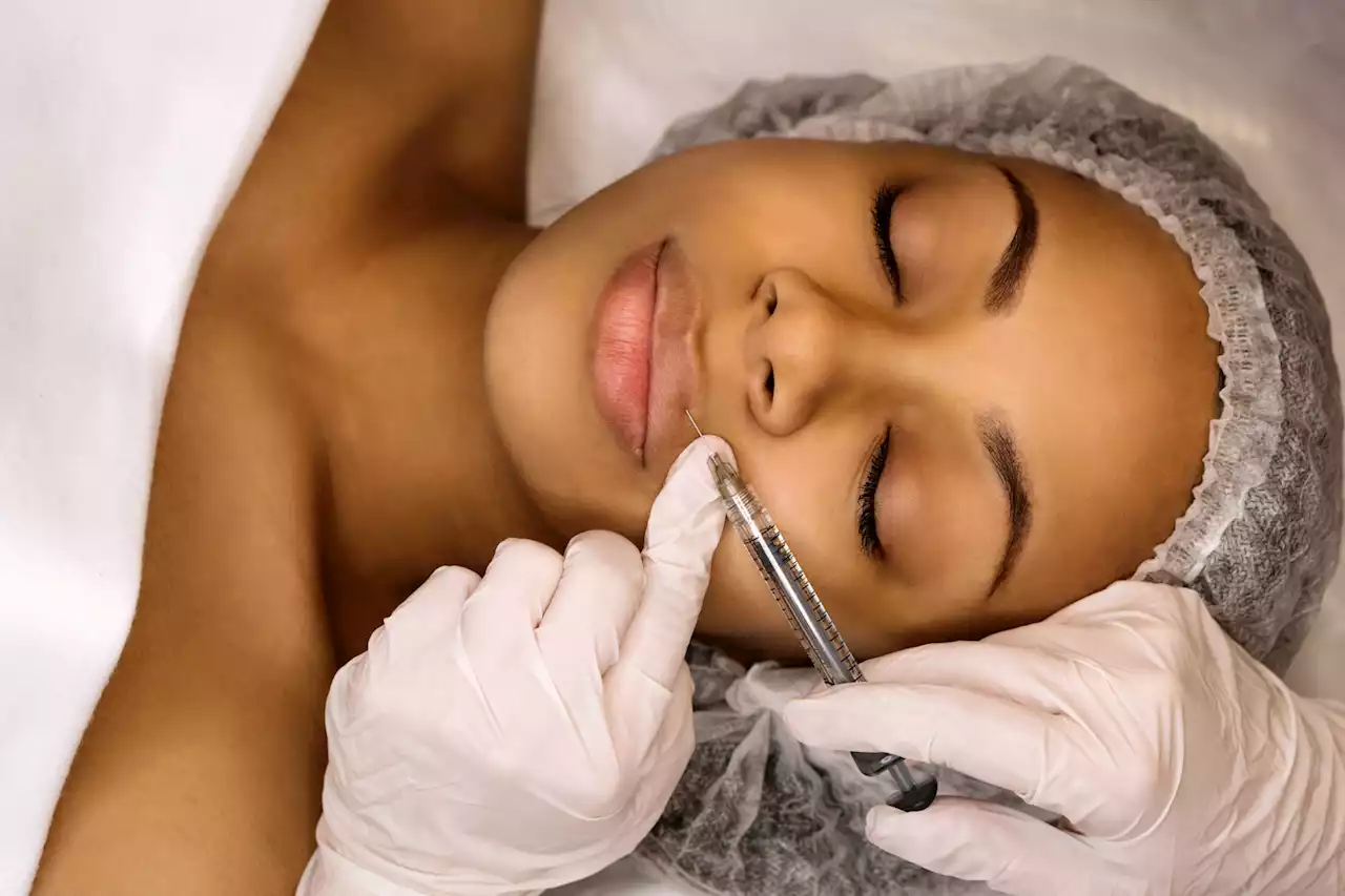 What is ‘filler face’ and why is it becoming a problem? | The Citizen