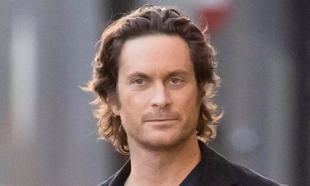 Oliver Hudson shares flare-up of upsetting condition