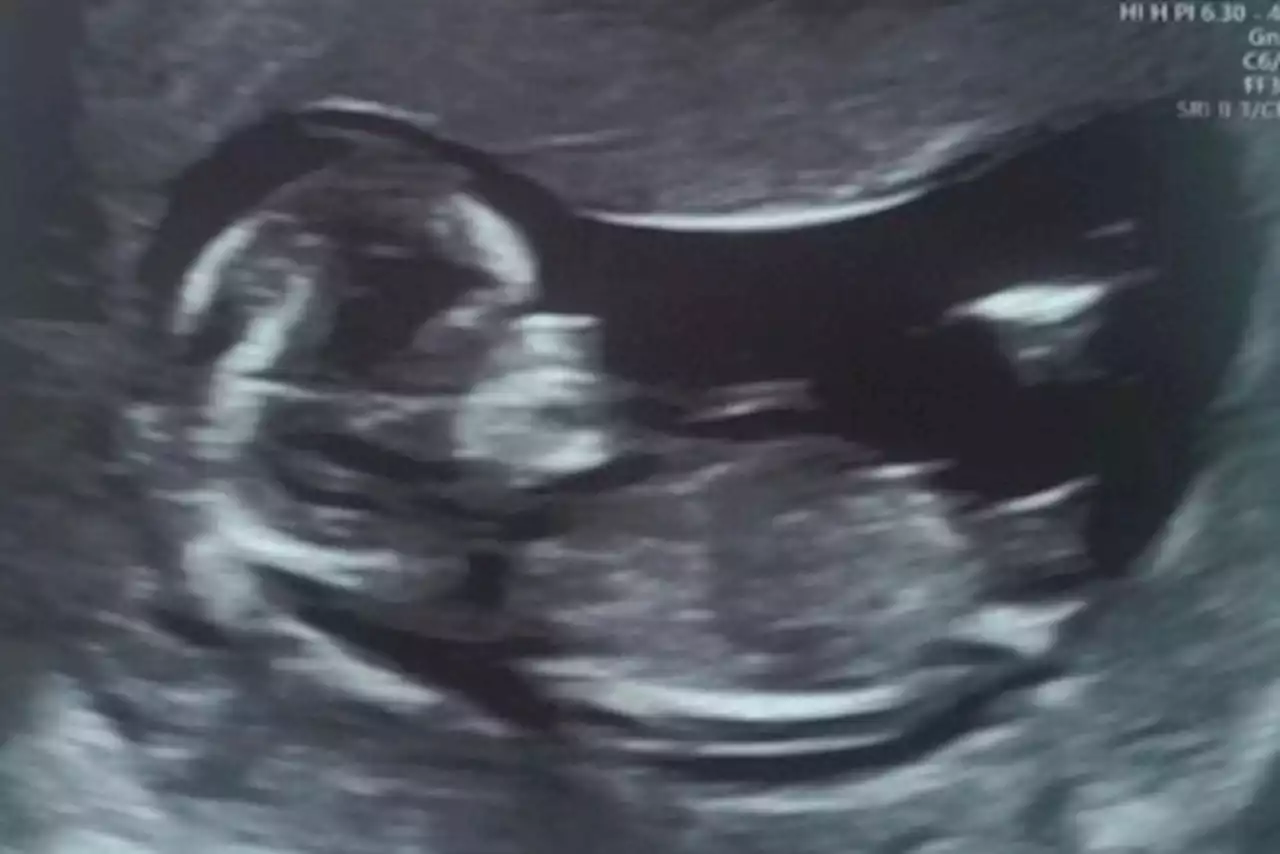 Geordie Shore star expecting their first baby and jokes 'it's time to grow up'