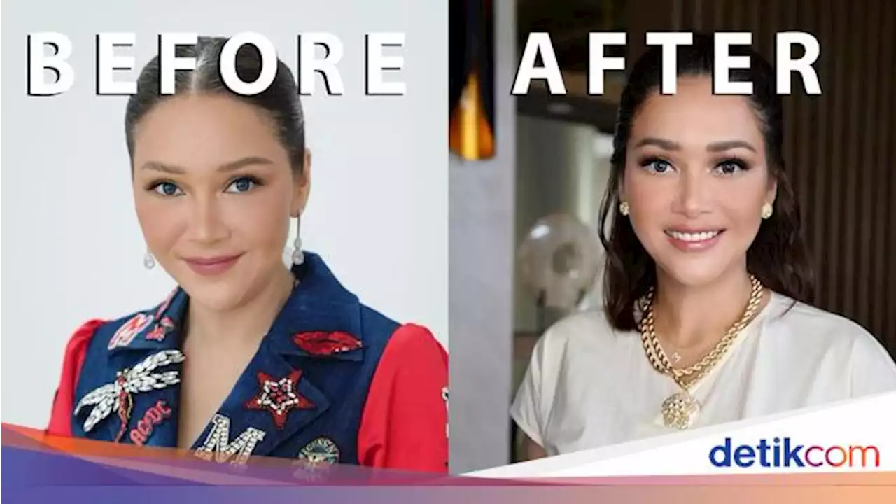 10 Potret Maia Estianty Sebelum vs Sesudah Laser-Botox