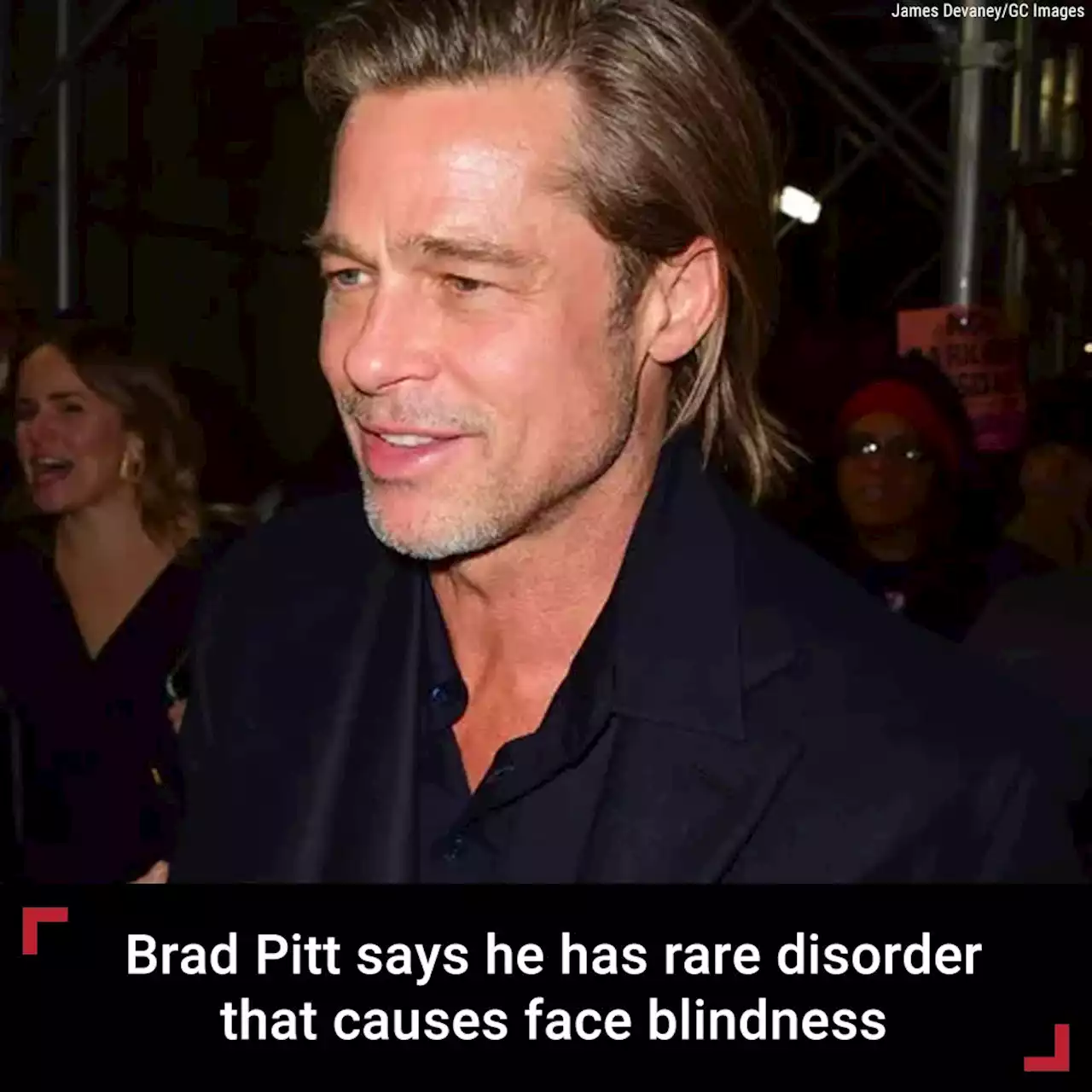 Brad Pitt says he has prosopagnosia, rare disorder that causes face blindness