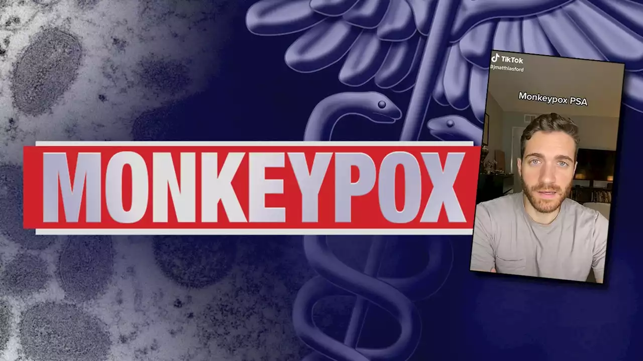 Monkeypox outbreak: A patient shares his painful experience with the disease