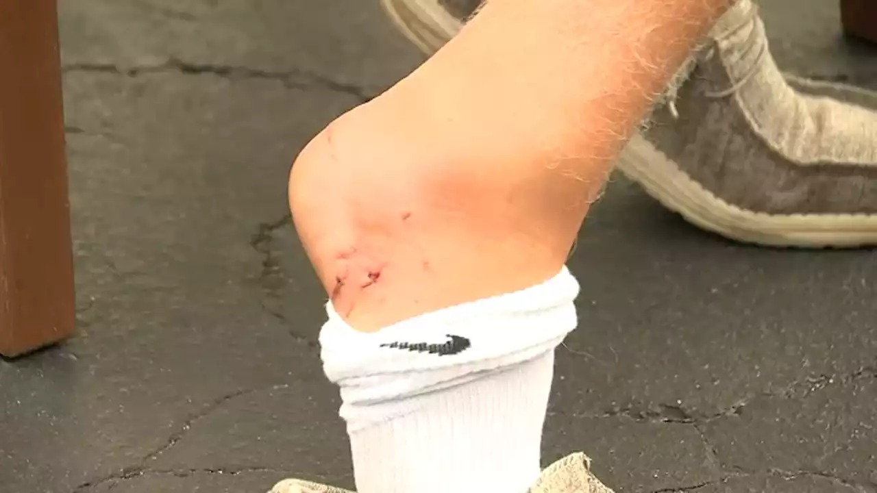 Teen lifeguard speaks out after bitten by shark on Fire Island