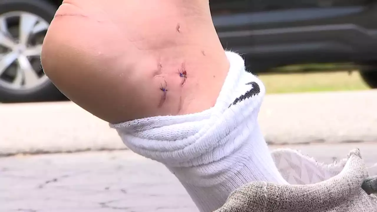 Lifeguard on NY's Fire Island Latest to Be Bitten by a Shark