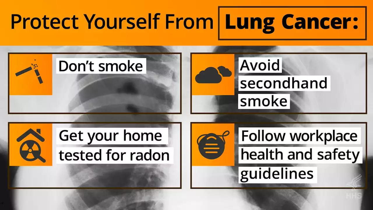 Lung Cancer Information for Health Care Providers | CDC