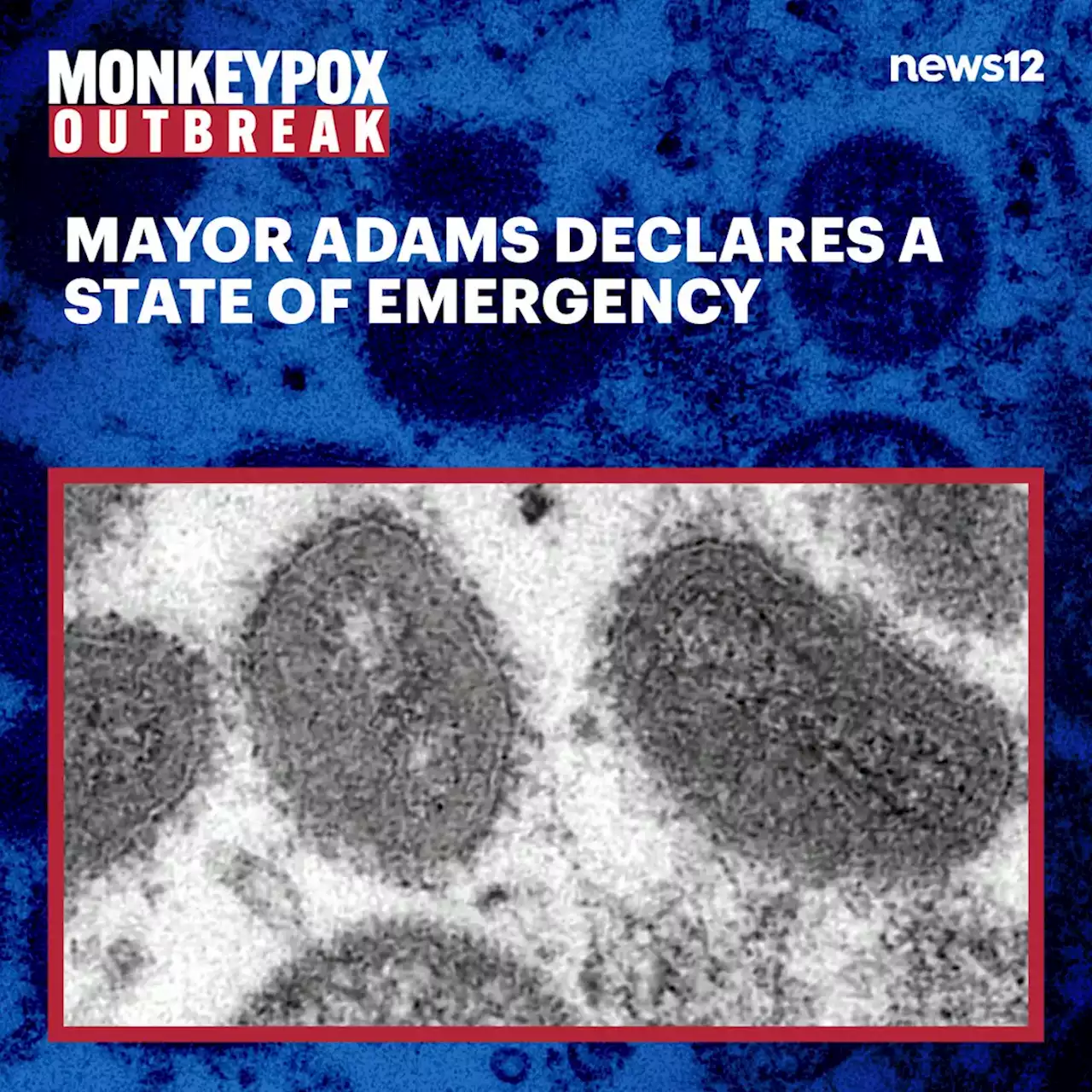 Mayor Adams declares local state of emergency in NYC due to monkeypox outbreak