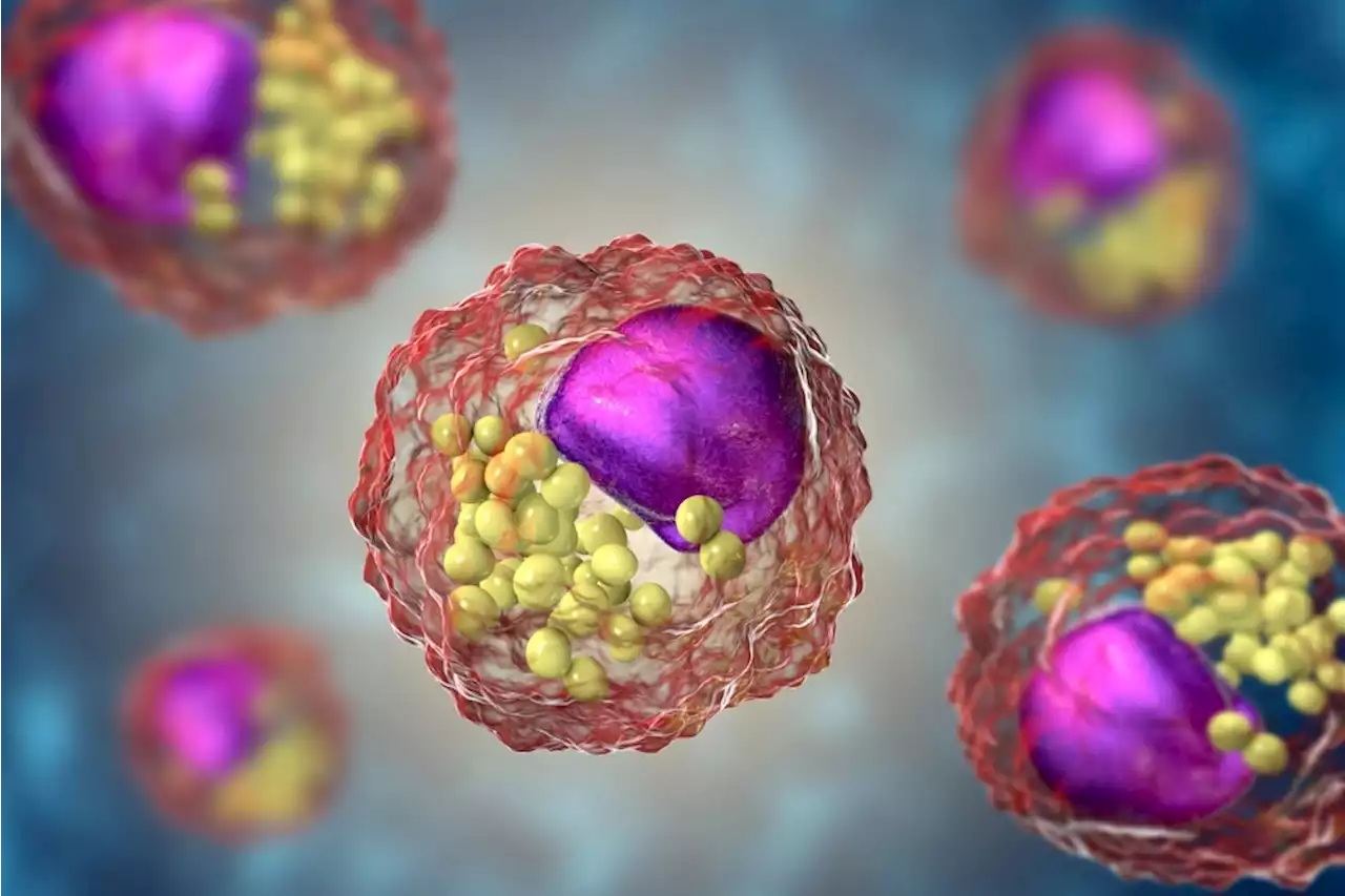 Nanoparticles' toxic effects on macrophages