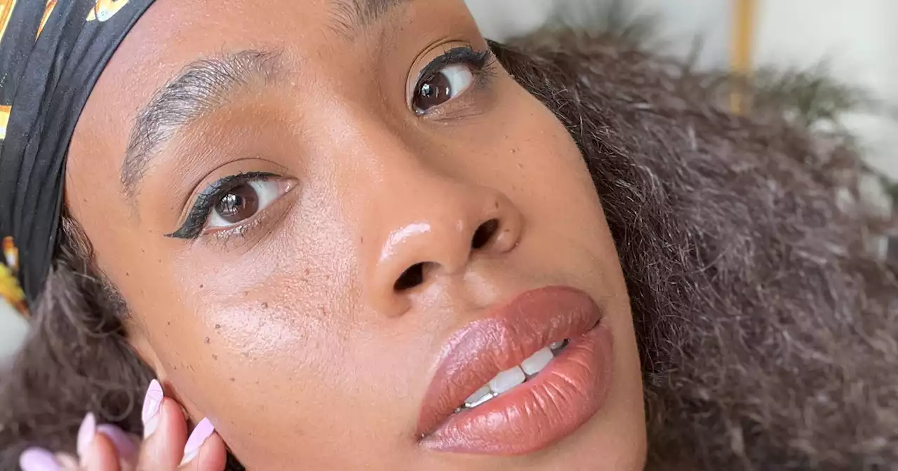 Turns Out Those “Black Girl Freckles” Are Actually Dermatosis Papulosa Nigra