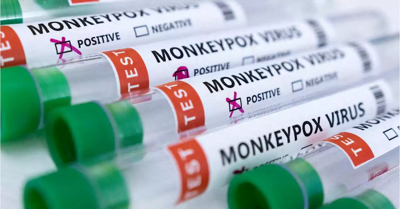 Sudan reports first confirmed Monkeypox case