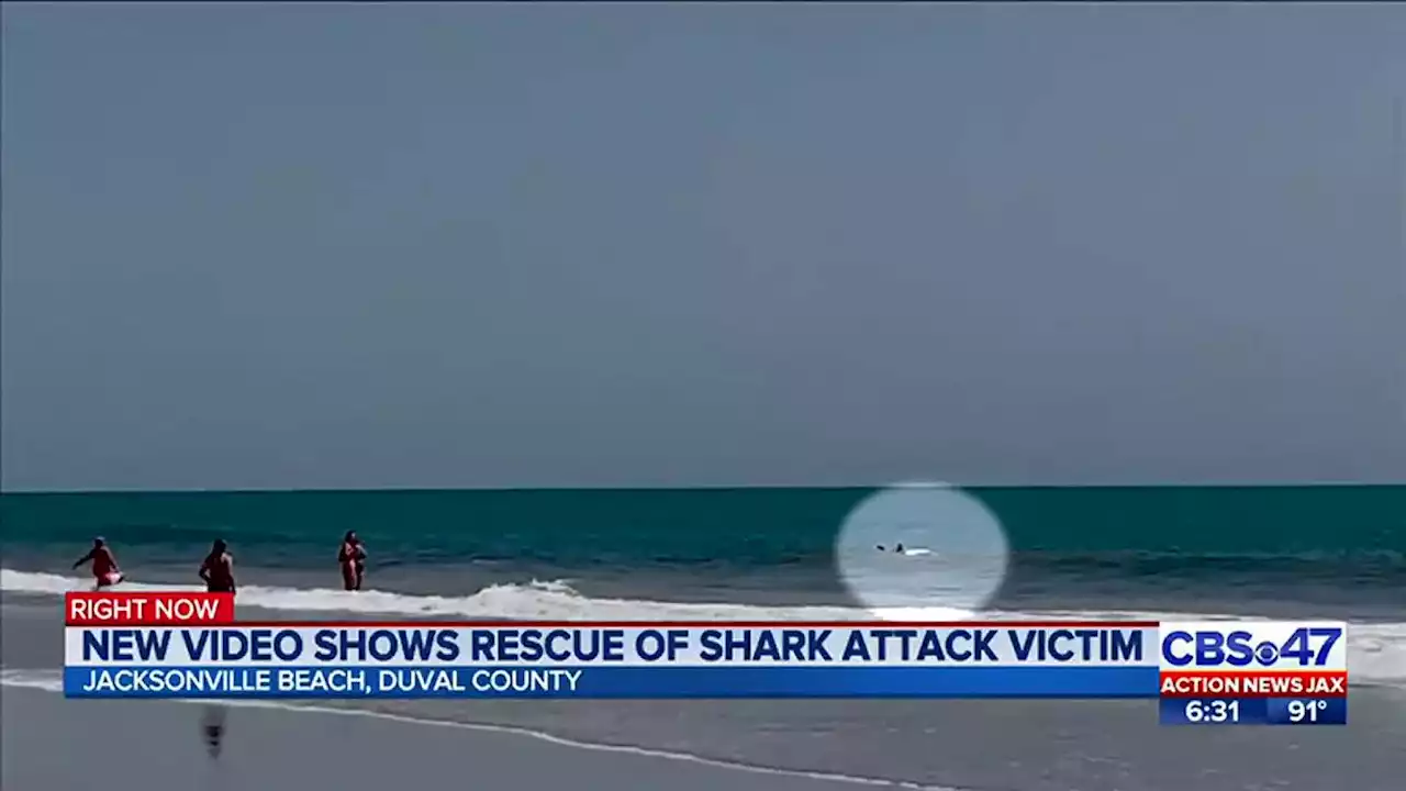 16-year-old makes quick decision to rescue swimmer bitten by shark at Jacksonville Beach