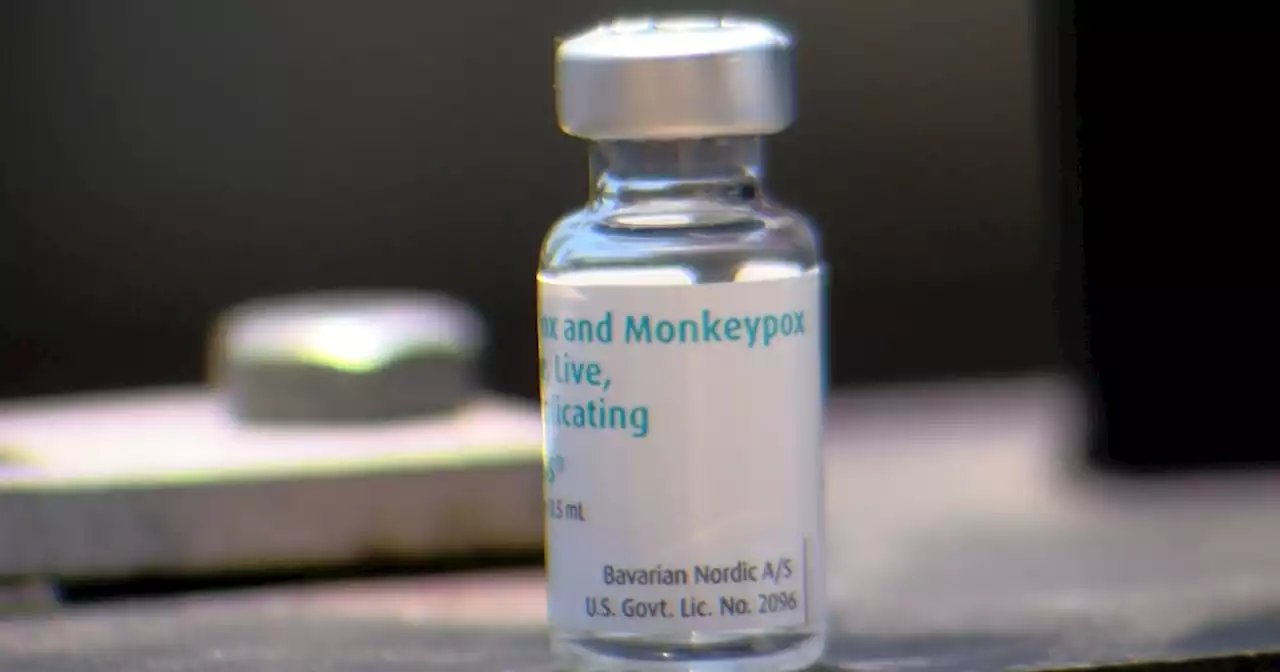 San Diego County supervisors ratify state of emergency on monkeypox