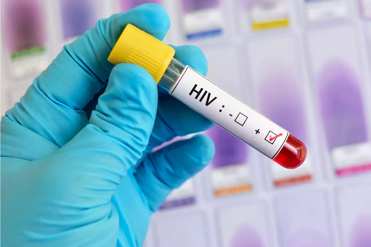 HIV is still a big threat in Africa | The Citizen